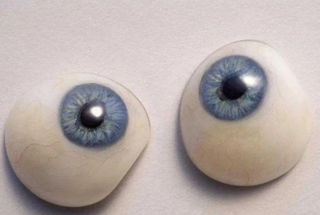 定制義眼